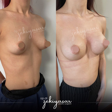 Slider image (9) Dr. Zeki Yasar Clinic